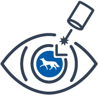 Лечение катаракты в Сургуте