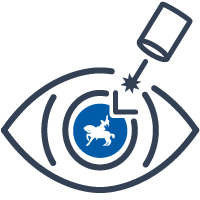 Лечение катаракты в Уфе