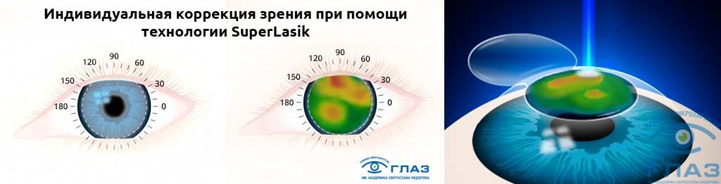 Суперласик.jpg Суперласик.jpg