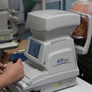 Что такое катаракта? Причины, симптомы, лечение
