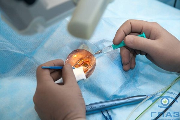Лечение катаракты в Уфе