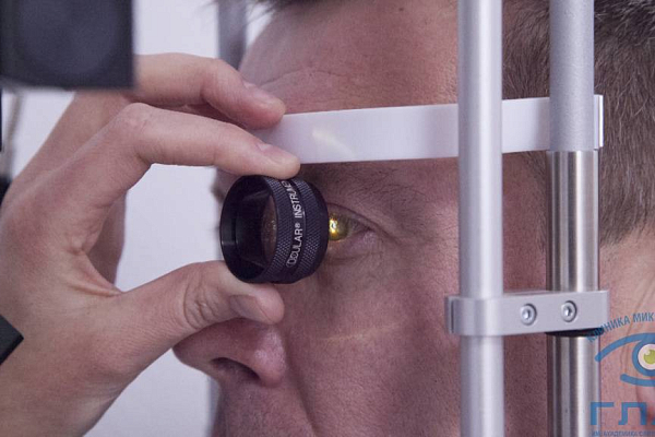 Селективная лазерная трабекулопластика