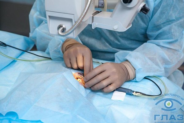 Лечение близорукости высоких степеней в Клинике микрохирургии "ГЛАЗ" им. Федорова