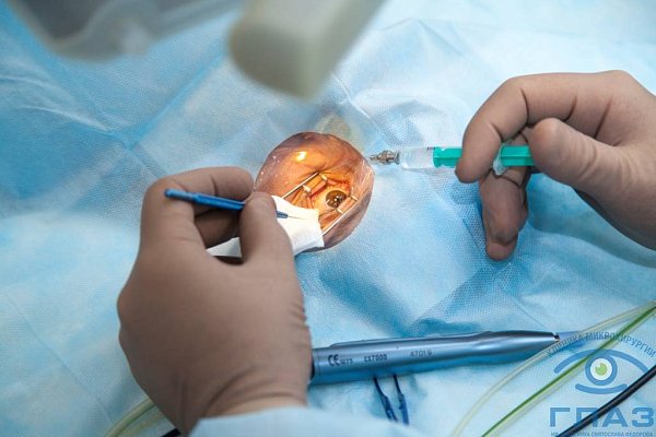 Лечение близорукости высоких степеней в Клинике микрохирургии "ГЛАЗ" им. Федорова